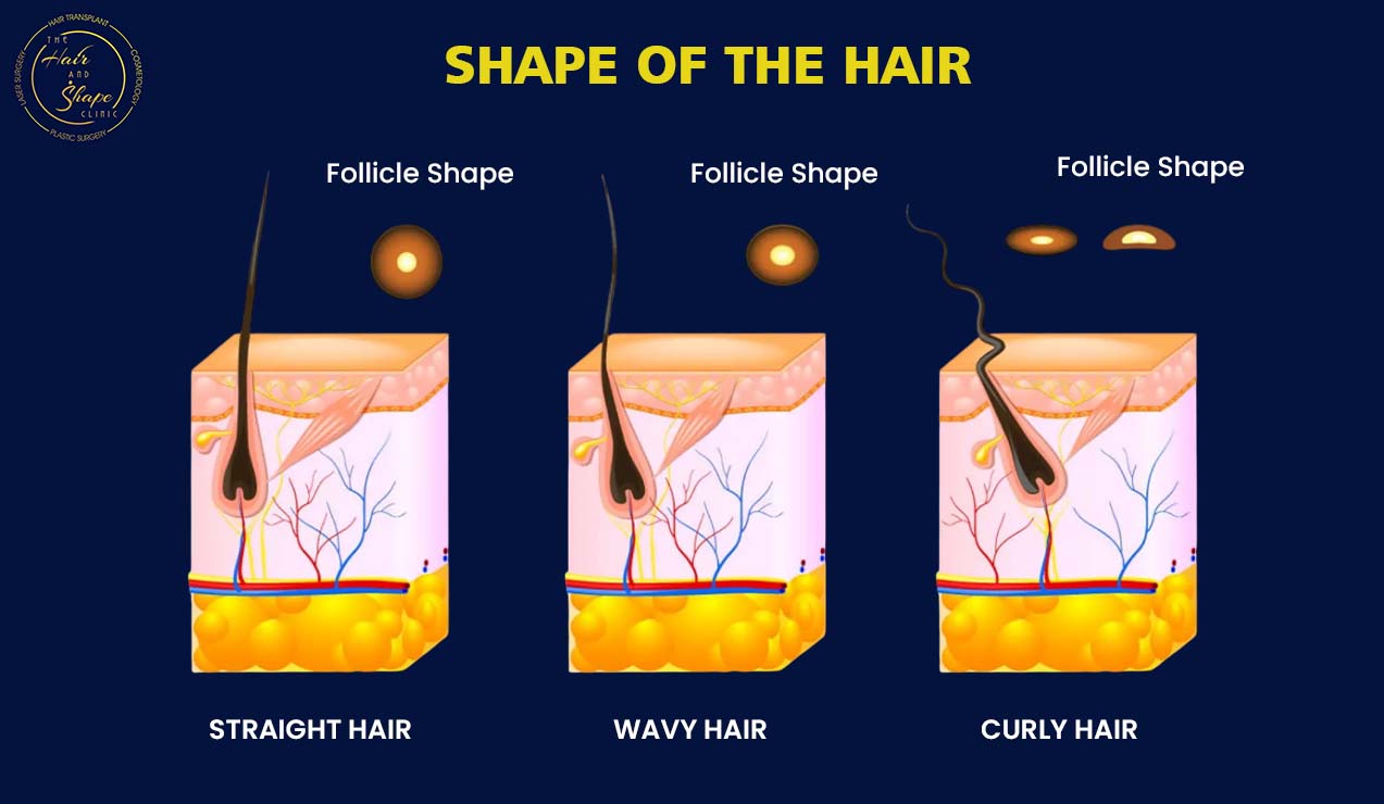 shape-of-afro-hair shape-of-afro-hair
