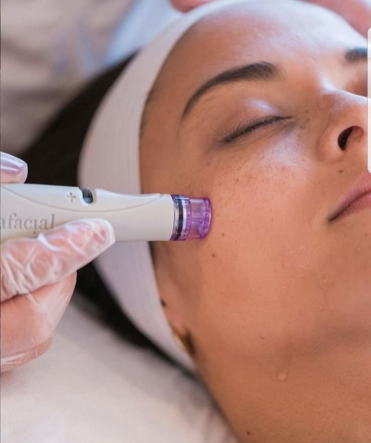Depigmentation Depigmentation image