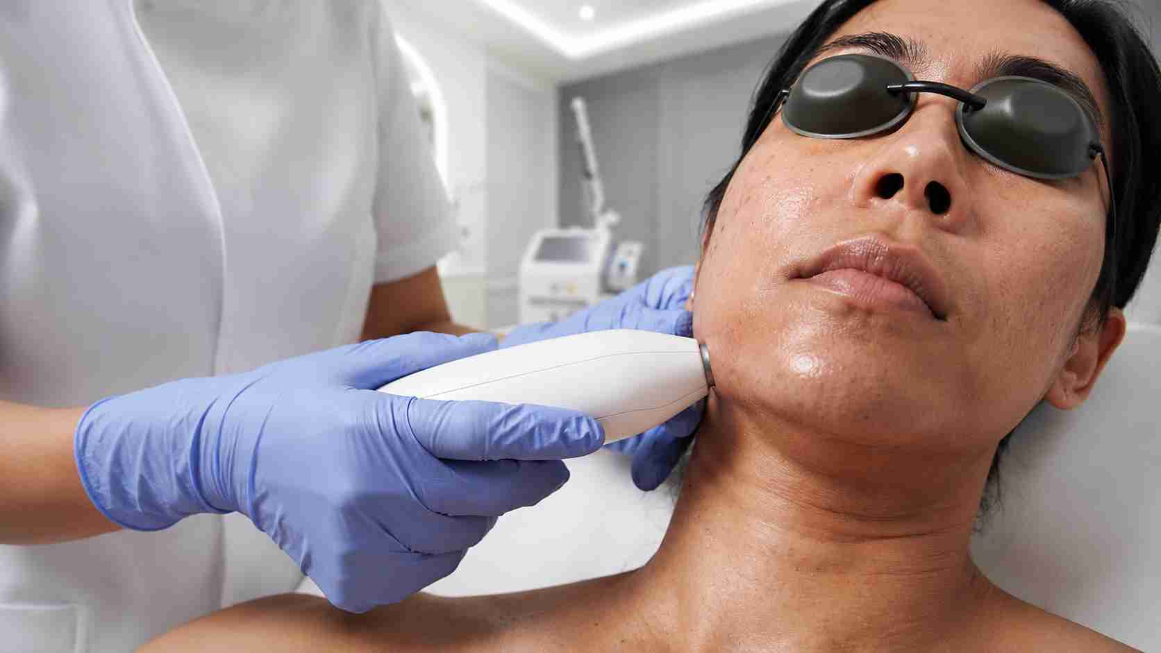 Depigmentation in Mumbai - The Hair and Shape Clinic